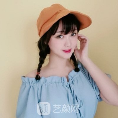 广州荔医整形医院隆鼻实例展示|亲测成果图曝光