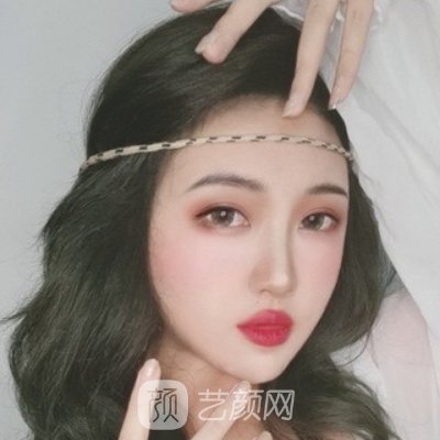 广州荔医整形医院隆鼻实例展示|亲测成果图曝光