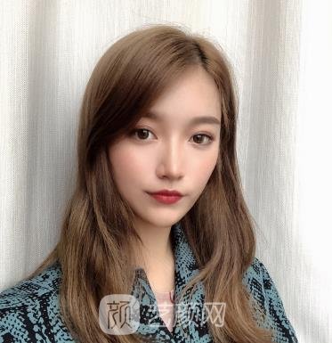 郑州集美张海洋隆鼻实例，真人修复过程图印证医生技术实力强