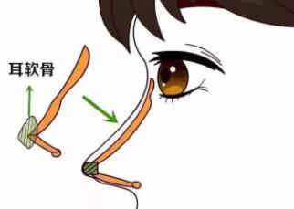 隆鼻动漫43.jpg 隆鼻动漫43.jpg