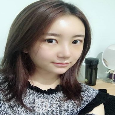 吴氏嘉美庄蔚强做鼻子怎么样?2022体验实例公开