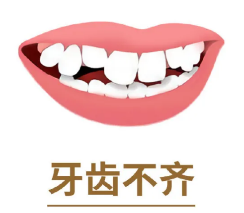 上海瑞金医院正畸(实例)多少钱？分享个人正畸实例，内含相关价格表