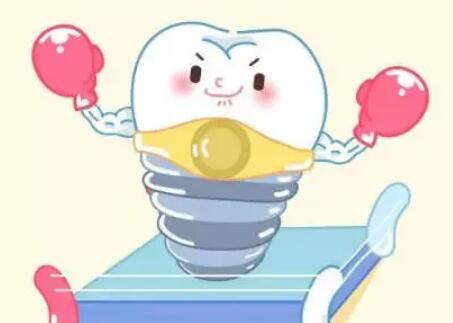 牙齿种植动漫15.jpg 牙齿种植动漫15.jpg