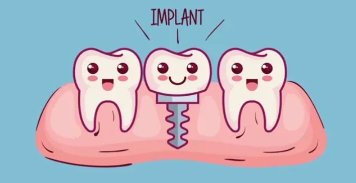牙齿种植动漫49.jpg 牙齿种植动漫49.jpg