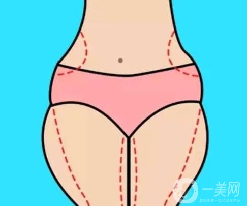 埋线减肥有哪些禁忌？能吃辣吗