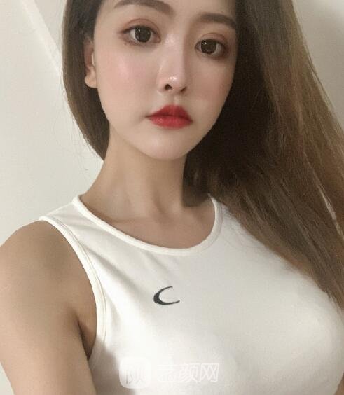 华美李健隆胸手术实例，术后胸部的手感很柔软自然