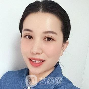 协和医院黄渭清个人简介|技术点评+双眼皮整形实例