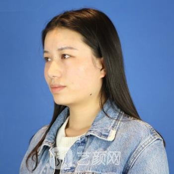 协和医院黄渭清个人简介|技术点评+双眼皮整形实例