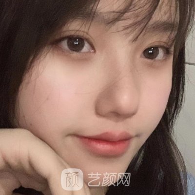 东莞依谋整形医院割双眼皮怎么样?全新体验实例发布