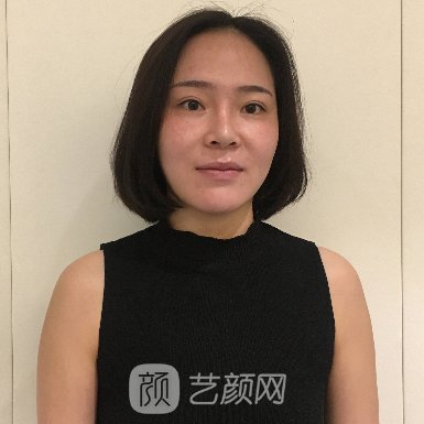 南京韩辰美容医院正规吗?20223隆胸实例曝光