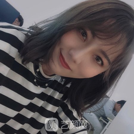 北京画美医院正规吗？医院实力及玻尿酸除皱实例分享