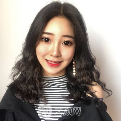 广东韩妃整形医院是三甲医院吗？2023玻尿酸填充实例发布