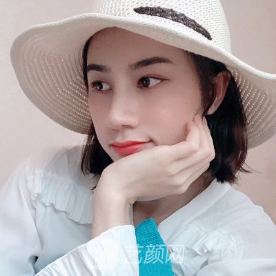 成都达芬奇医疗美容医院正规吗？2023隆鼻实例一览
