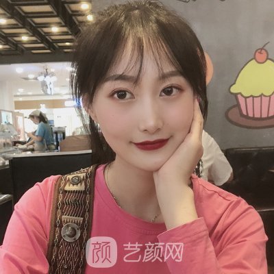合肥智善美整形医院割双眼皮怎么样？成果有保护