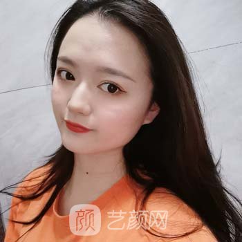 割双眼皮一到7天图片展示，真人修复全过程公开