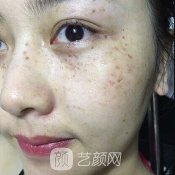重庆美康医疗美容医院吴德莉电话|技术怎么样？附实例