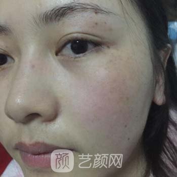 重庆美康医疗美容医院吴德莉电话|技术怎么样？附实例