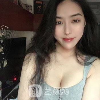 魏家宾做隆胸实例，拥有了圆润的胸部后，每天都乐呵呵的