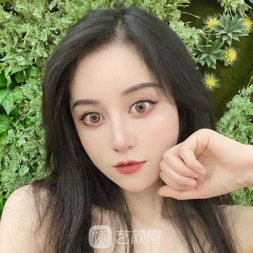 四川友谊医院做下颌骨怎么样?2023招牌实例展示