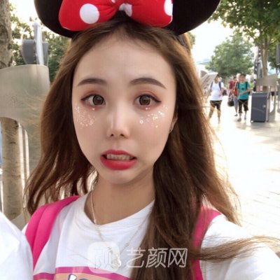 南昌时光整形医院杨琦做双眼皮怎么样?亲身体验实例一览