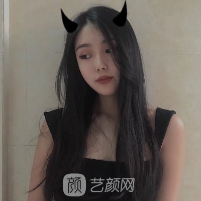 南昌敖蓓玲医生割双眼皮怎么样?90天体验实例出炉