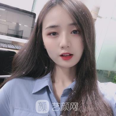 郑康在磨骨实例，手术前后对比差别大，拥有精致小脸
