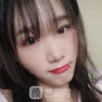 齐鲁医院植发怎么样？概况介绍+发际线移植实例，价目表