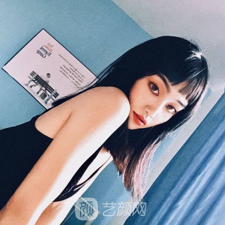 成都景华整形医院怎么样?全新吸脂实例公开