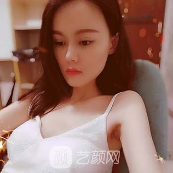 夏国兴隆胸实例，术后可以驾驭各种美丽性感的衣服！