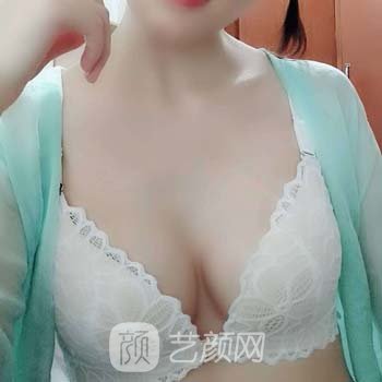 夏国兴隆胸实例，术后可以驾驭各种美丽性感的衣服！