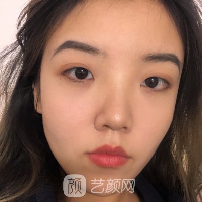 何照华磨骨实例分享|全新体验成果图集中一览