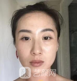 八大处拉皮骨干医生名单介绍|口碑评价|拉皮除皱实例对比图