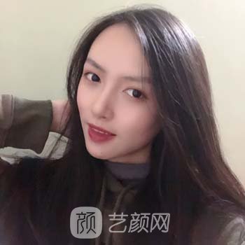 魏紫林整形医生怎么样？坐诊医院介绍+隆鼻整形实例
