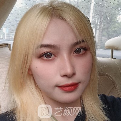 广美整形美容医院点阵激光实例曝光|成果自然无痕