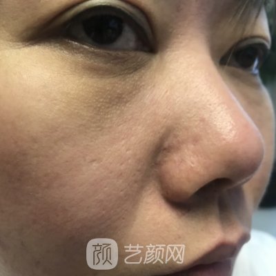 江西省儿童医院整形科怎么样?2023疤痕修复实例一览