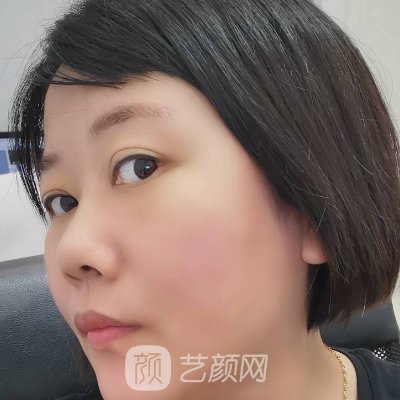 江西省儿童医院整形科怎么样?2023疤痕修复实例一览
