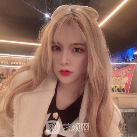 昆明美莱整形医院面部脂肪填充实例分享|内附体验成果图