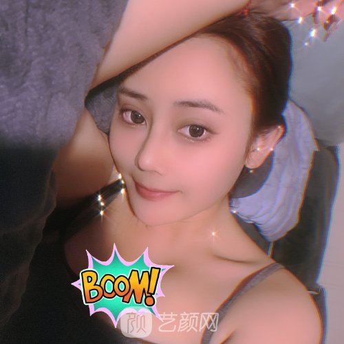 魏亨坤隆鼻修复好吗?医生实力及实例出炉