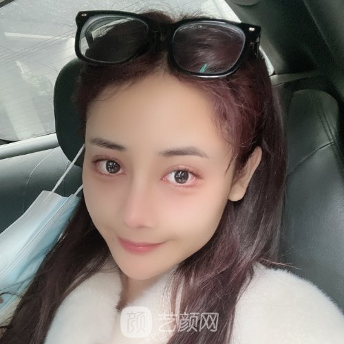 魏亨坤隆鼻修复好吗?医生实力及实例出炉
