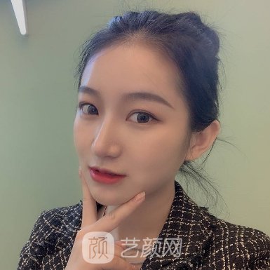 深圳京韩整形医院正规吗?隆鼻实例及成果图展示