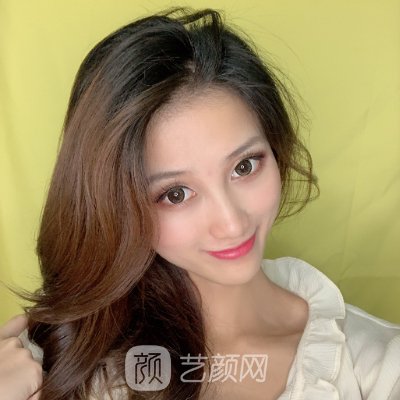 成都军大任义做鼻子怎么样?医生实力及实例一览。