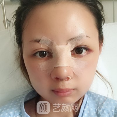 长沙梵童整形医院做鼻子怎么样?2023全新体验实例发布