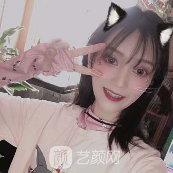 滨湖医院可以整牙吗？多少钱？牙齿矫正医生介绍+实例