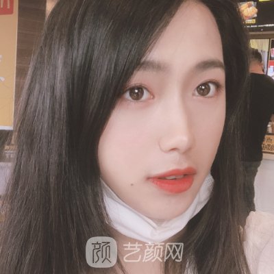 广州华美整形医院是三甲医院吗?2023注射除皱实例分享