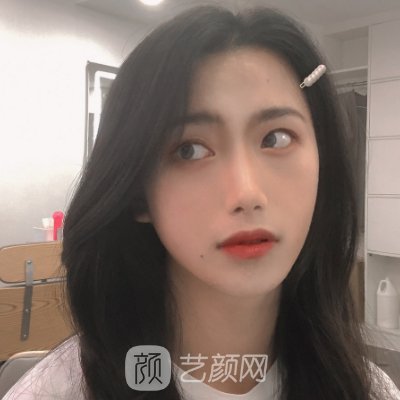 广州华美整形医院是三甲医院吗?2023注射除皱实例分享