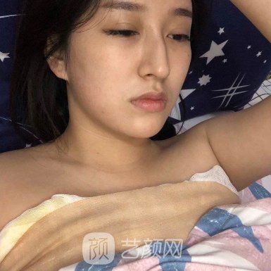 广州郭震宇医生隆胸实例曝光|2023全新体验实例出炉
