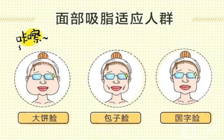 成都面部吸脂多少钱?价格影响因素大盘点