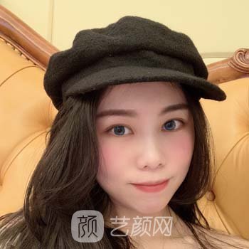 浙江省中医院整形美容价格表|实力骨干医生介绍|双眼皮实例