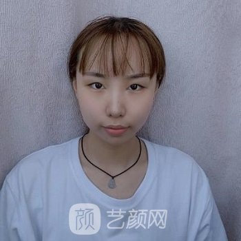 沈阳七院有美容科吗？多少钱？医生介绍+双眼皮实例