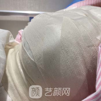 梁东北隆胸实例，拥有了魔鬼般的身材，穿性感衣服很显身材